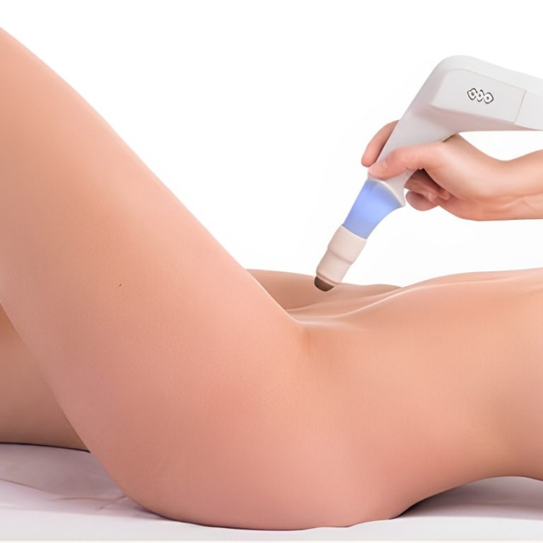 LASER-DE-CO2-MONALISA-TOUCH